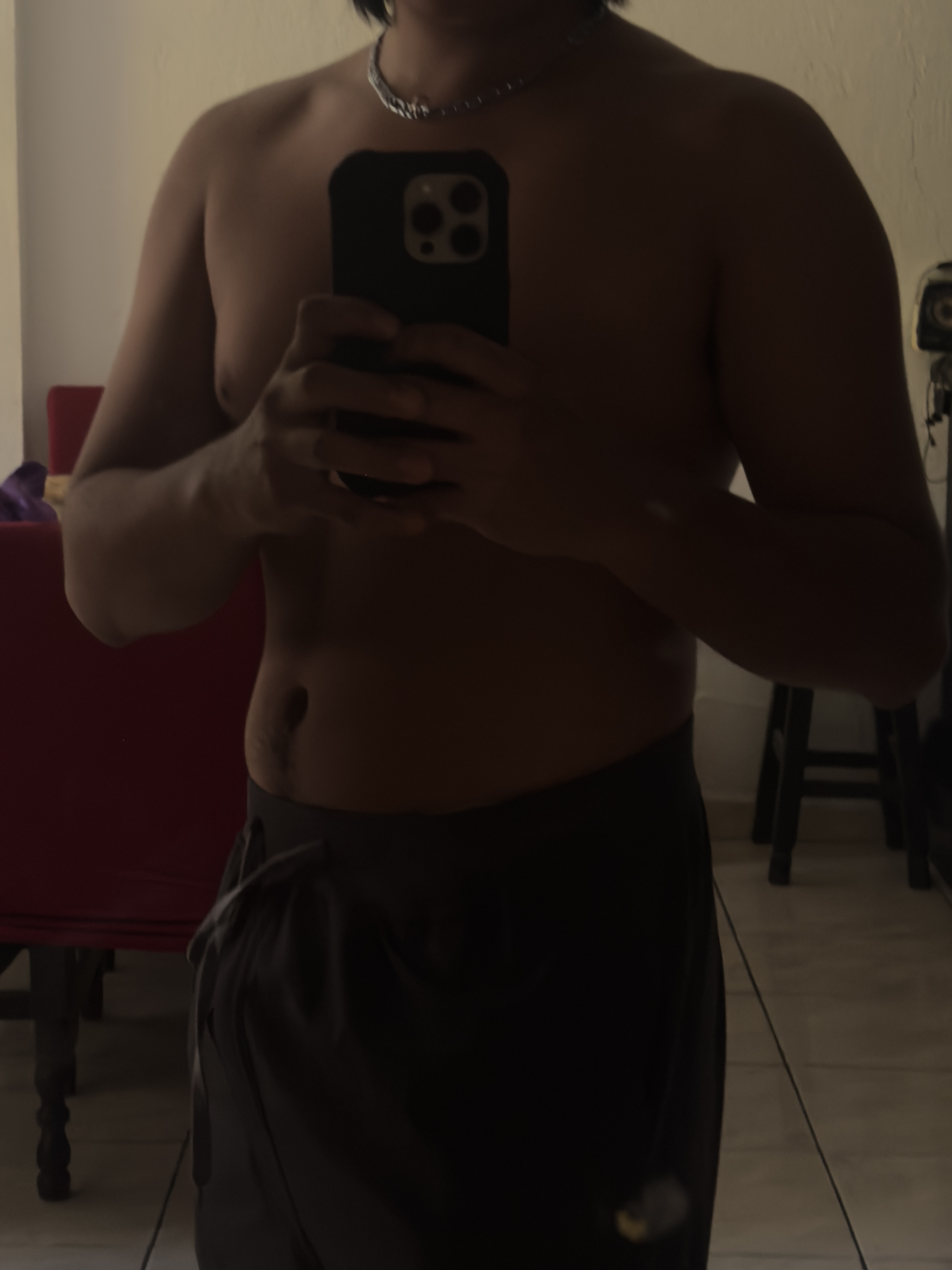 Goloprost
