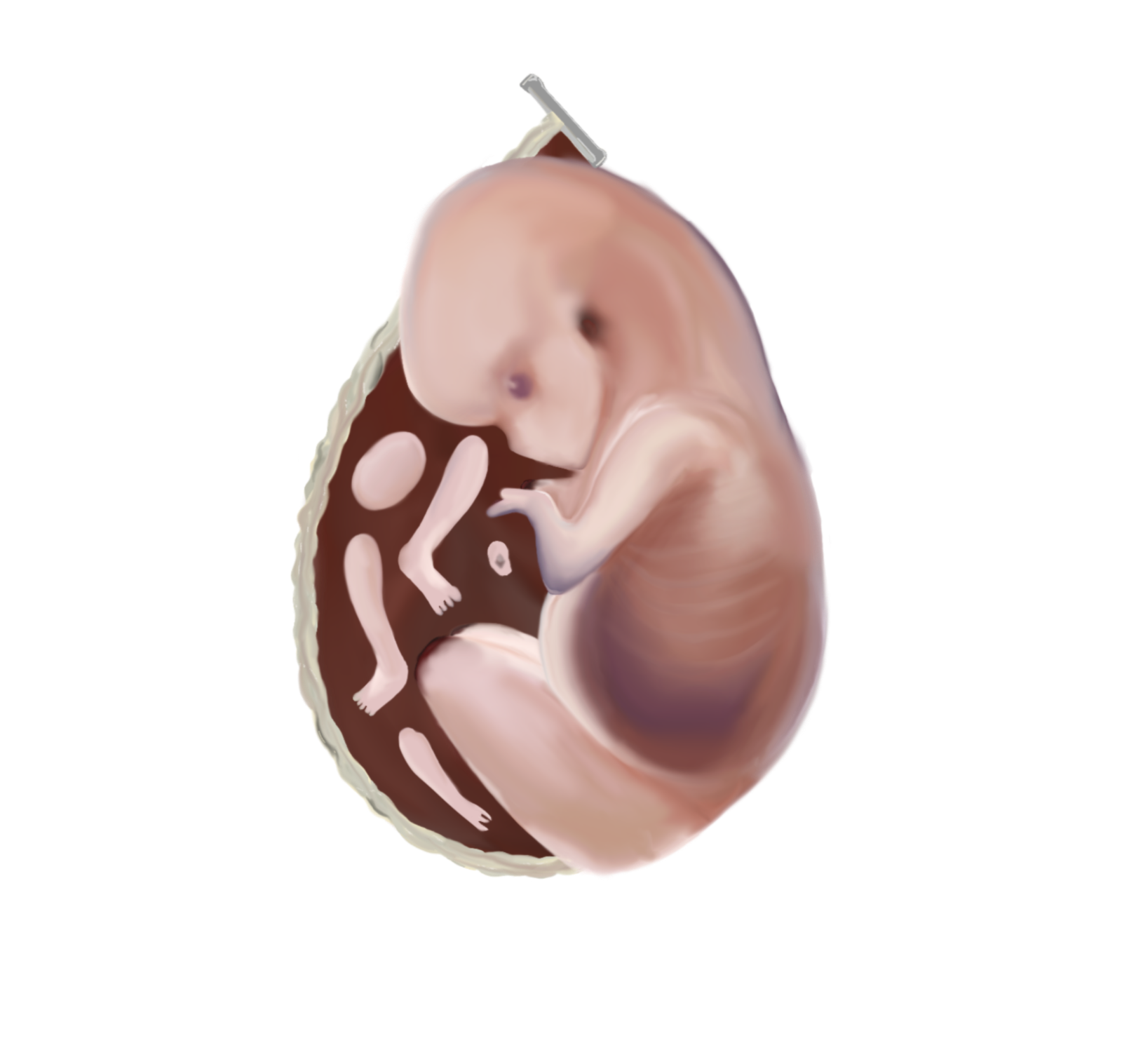 Fetus Soup